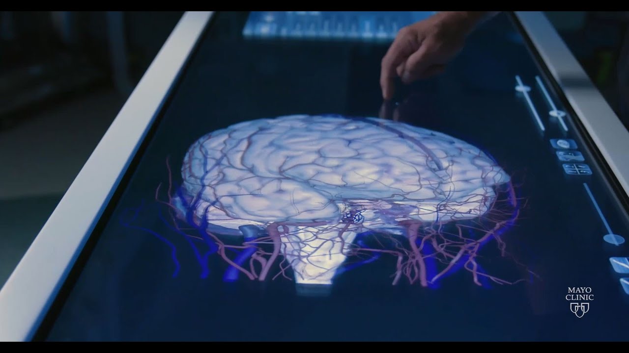 Stroke Awareness &mdash; Neurovascular Disease Explained