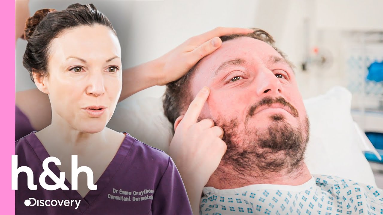 Esta dermatitis no lo deja jugar con sus hijos | Clínica de la Piel | Discovery H&H