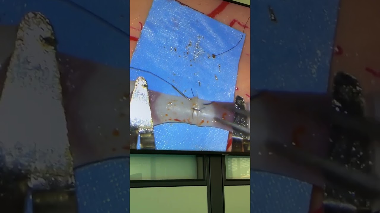 Microsuture Techniques Course | End-to-End Anastomosis