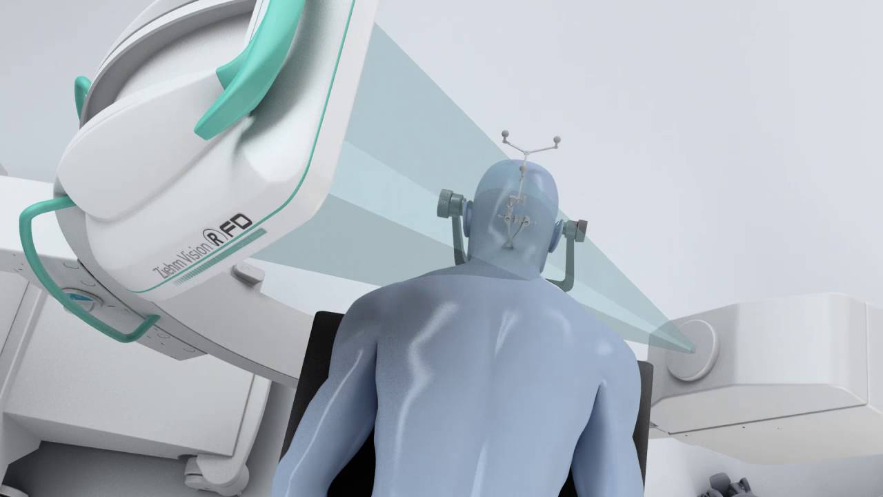 Ziehm Vision RFD 3D with Brainlab navigation.