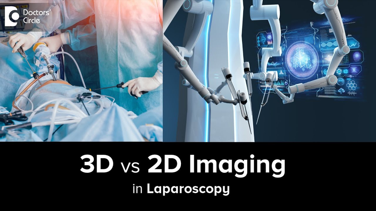 3D VS 2D Imaging in Laparoscopy | Pros & Cons | Robotic Surgery - Dr. Nanda Rajneesh|Doctors' Circle