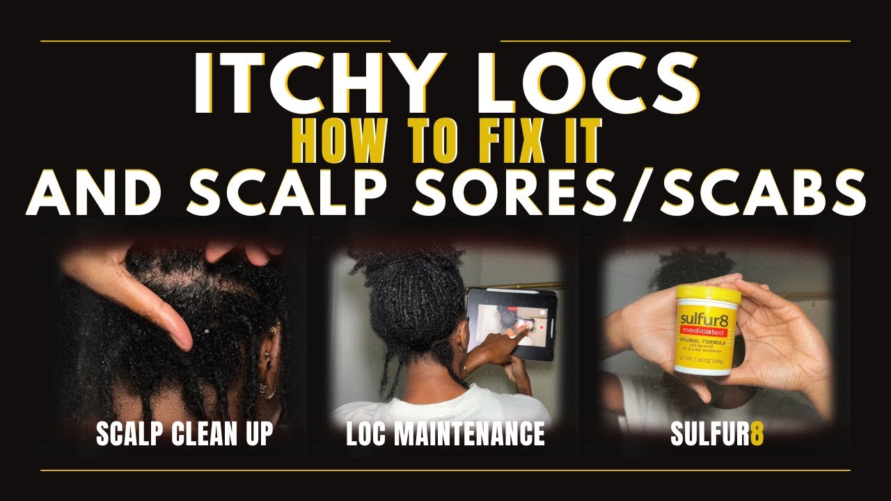 How to Fix Itchy Locs and Scalp Sores/Scabs