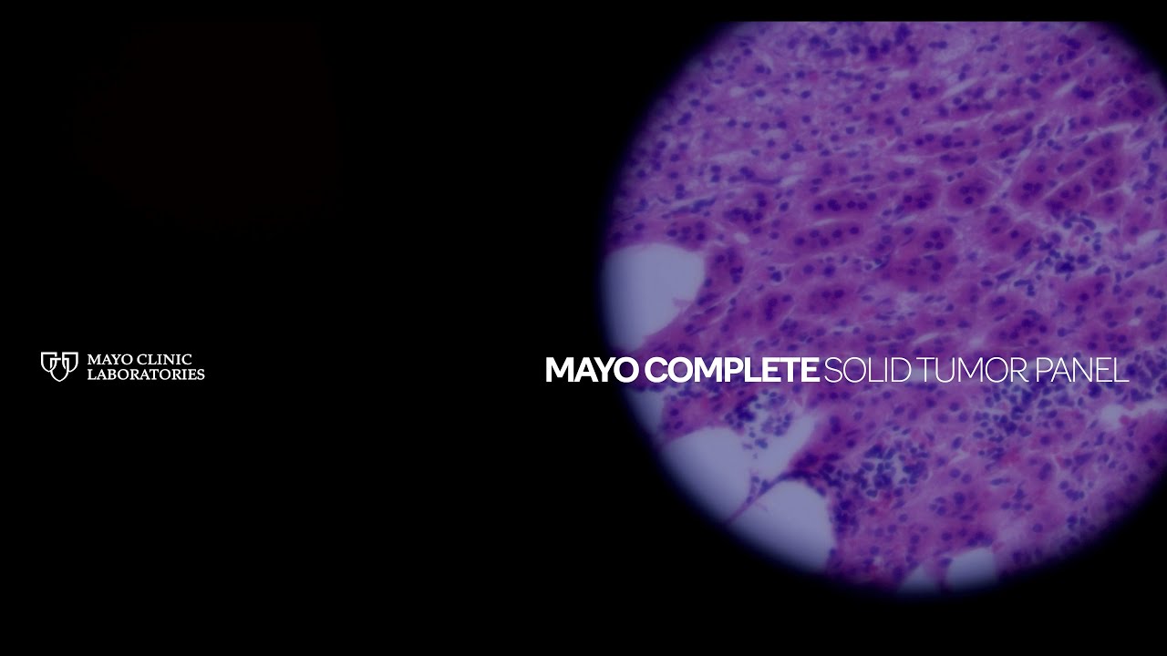 MayoComplete Solid Tumor Panel