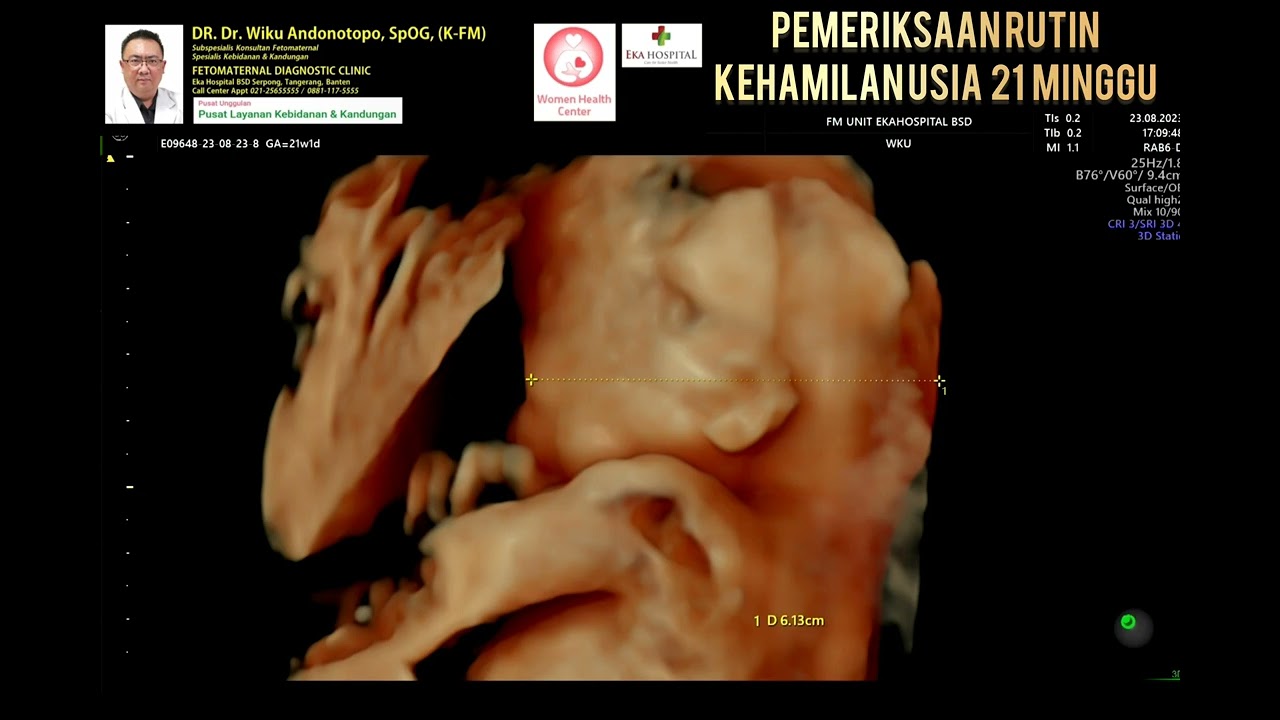 Pemeriksaan kehamilan 21 minggu