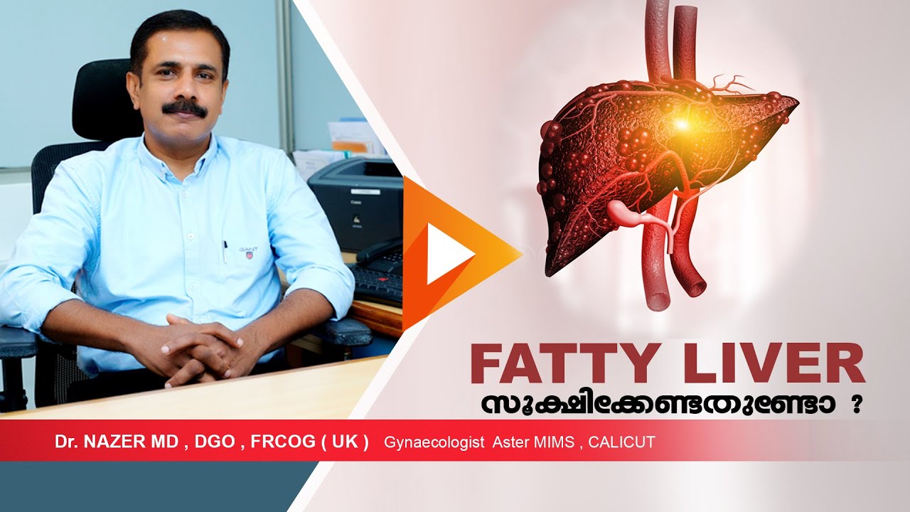 FATTY LIVER | ഫാറ്റിലിവര്‍ ശ്രദ്ധിക്കേണ്ടതുണ്ടോ | Dr Nazer | MALAYALAM