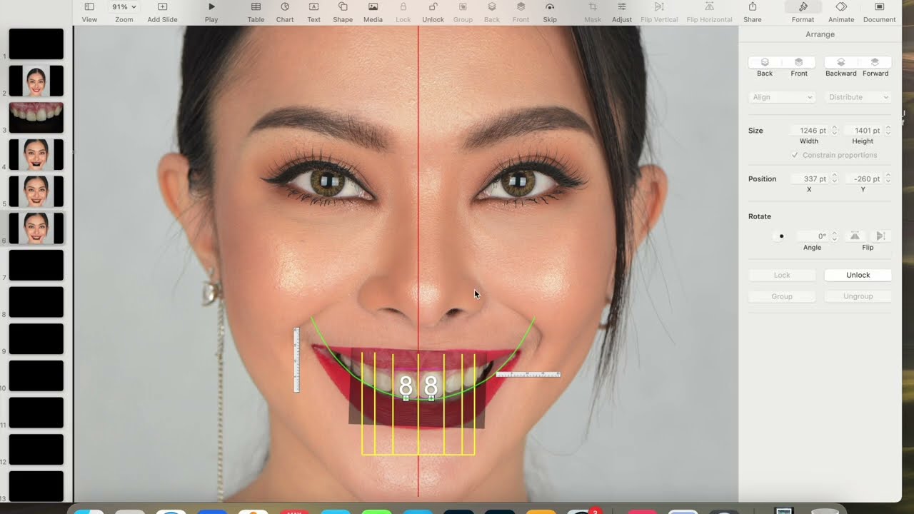 Architect smile design using Keynote software. The veneer bootcamp course.