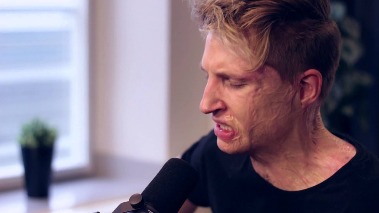 Axel Schylstr&ouml;m - Torn (Live @ East FM)