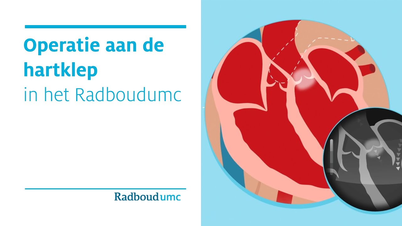 Operatie aan de hartklep