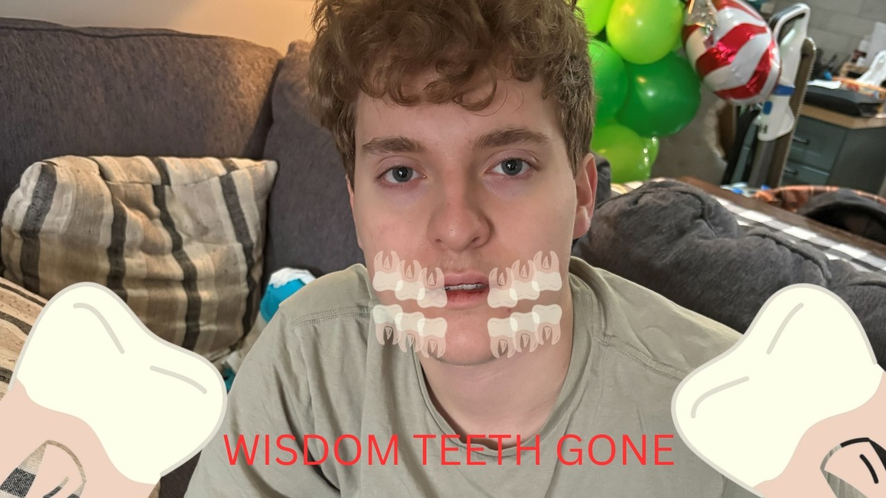 I Got My Wisdom Teeth Out!
