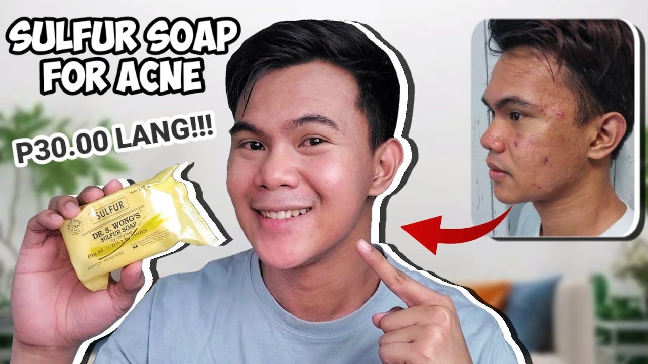 DR S WONG'S SULFUR SOAP REVIEW | MURANG SOLUSYON SA PIMPLES | DR S WONG SULFUR SOAP (YELLOW)