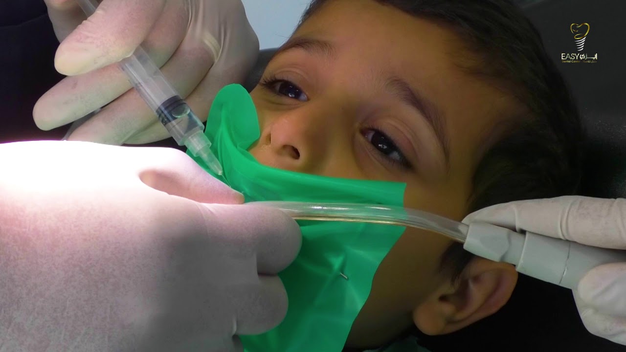 علاج أسنان طفلك أسهل - تجربة الطفل عبد الله