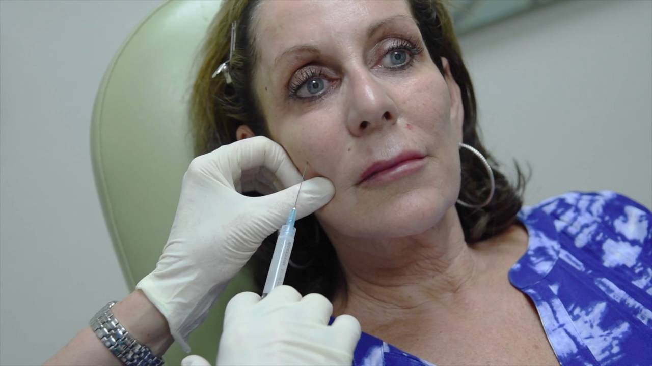 Sculptra - Best product for Collagen &Elastin  Creation!