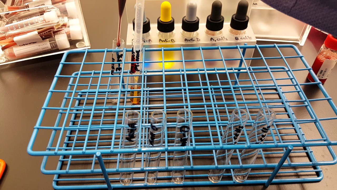 Blood Banking: how to make a 3-5% Red Cell Suspension