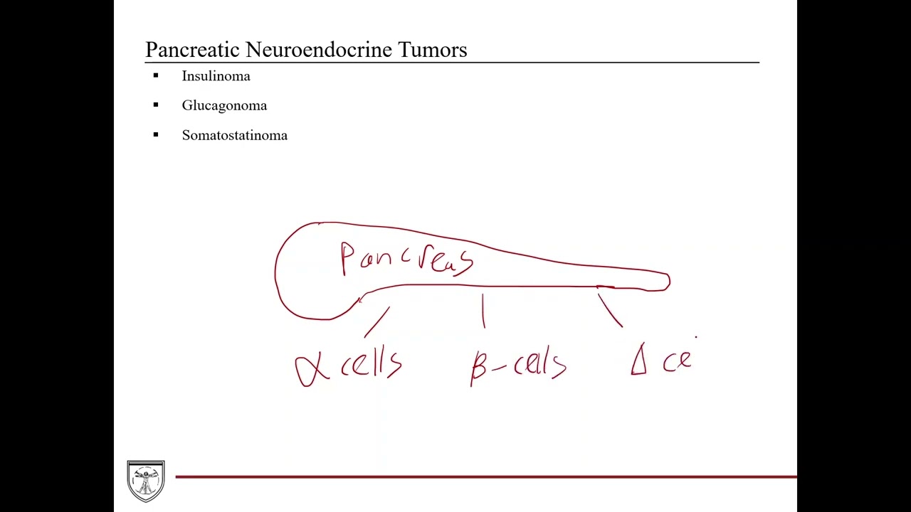 Diabetes Mellitus Type II and Pancreatic Neuroendocrine Tumors [Clinical Biochemistry 6 of 8]