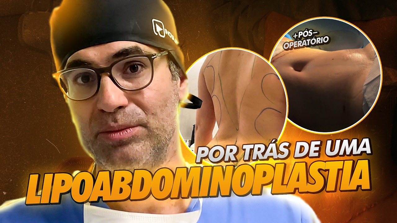 TODO O PROCESSO DE LIPOABDOMINOPLASTIA