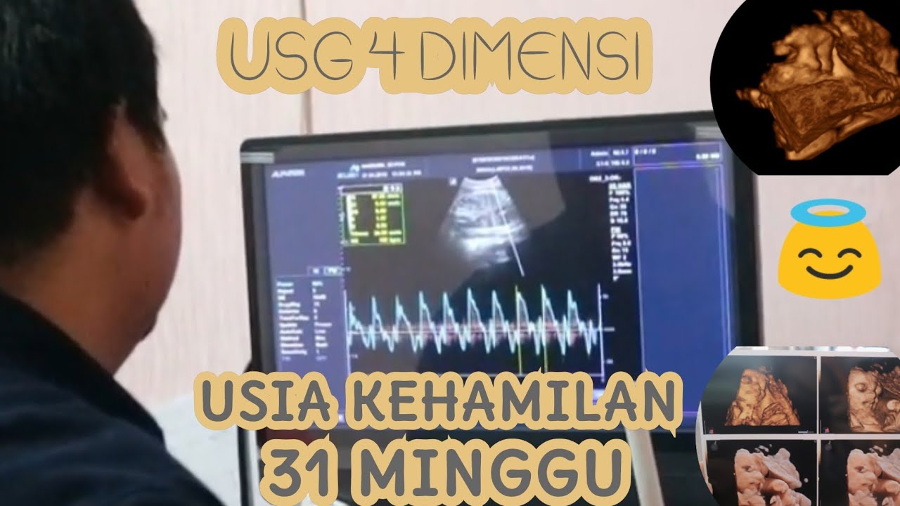 USG 4 DIMENSI ( 4D) USIA KEHAMILAN 31 MINGGU @ Hai Bumil ID Depok | KEHAMILAN