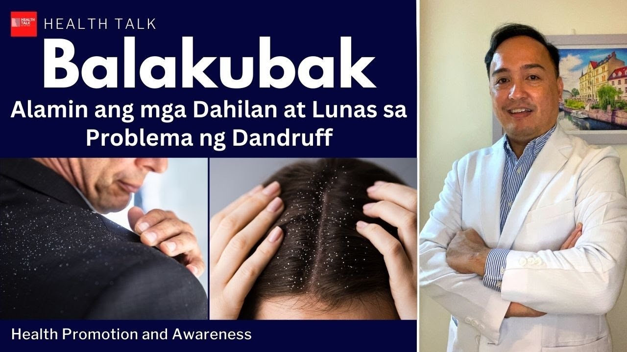 Dandruff (Balakubak): Mga Natural na Paraan sa Pag-alis ng Anit na Makati
