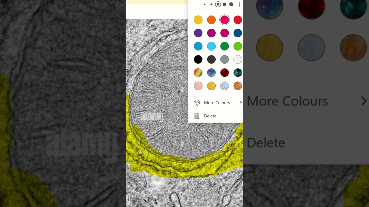 Difference between Golgi apparatus and RER in electron micrographs