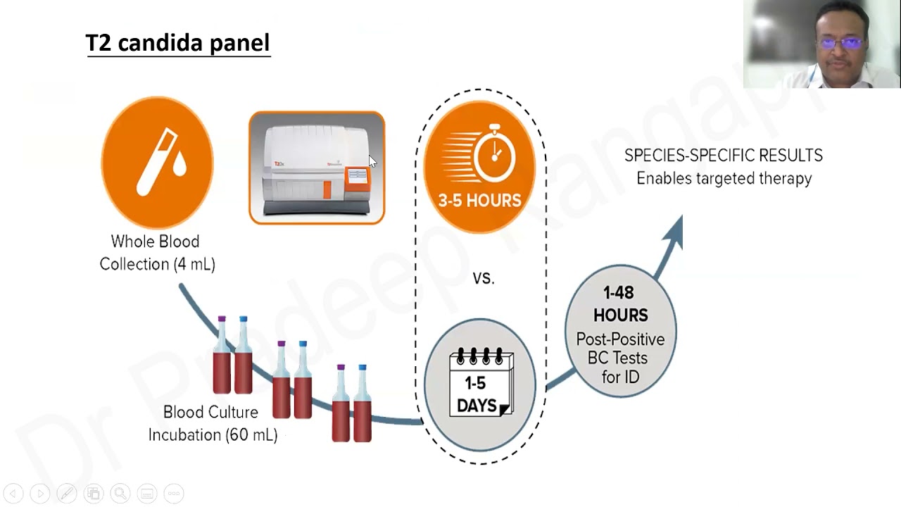 Fungal Infection - Can we control it ? | Dr. Pradeep Rangappa