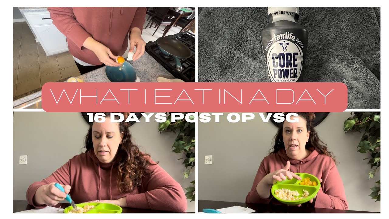 WHAT I EAT IN A DAY VSG| 2 weeks post op Gastric Sleeve