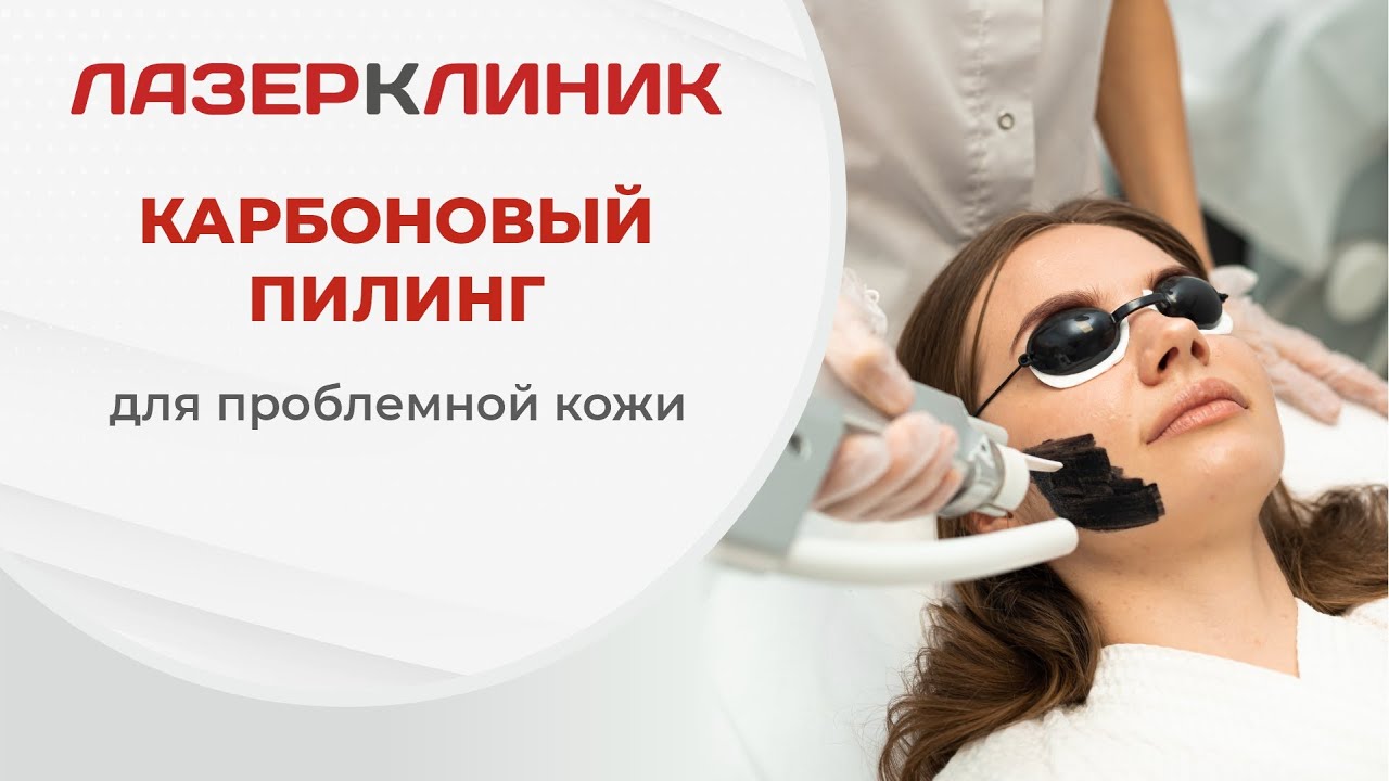 Лазерный карбоновый пилинг