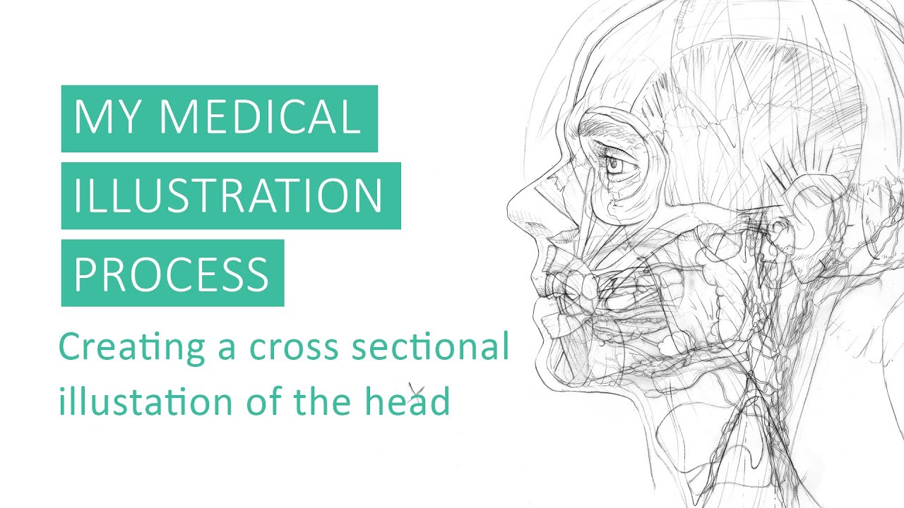 A Brief Overview of my Medical Illustration Process by Annie Campbell