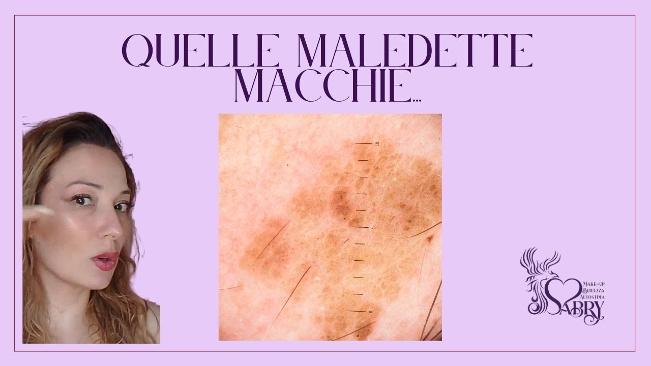 QUELLE MALEDETTE MACCHIE...