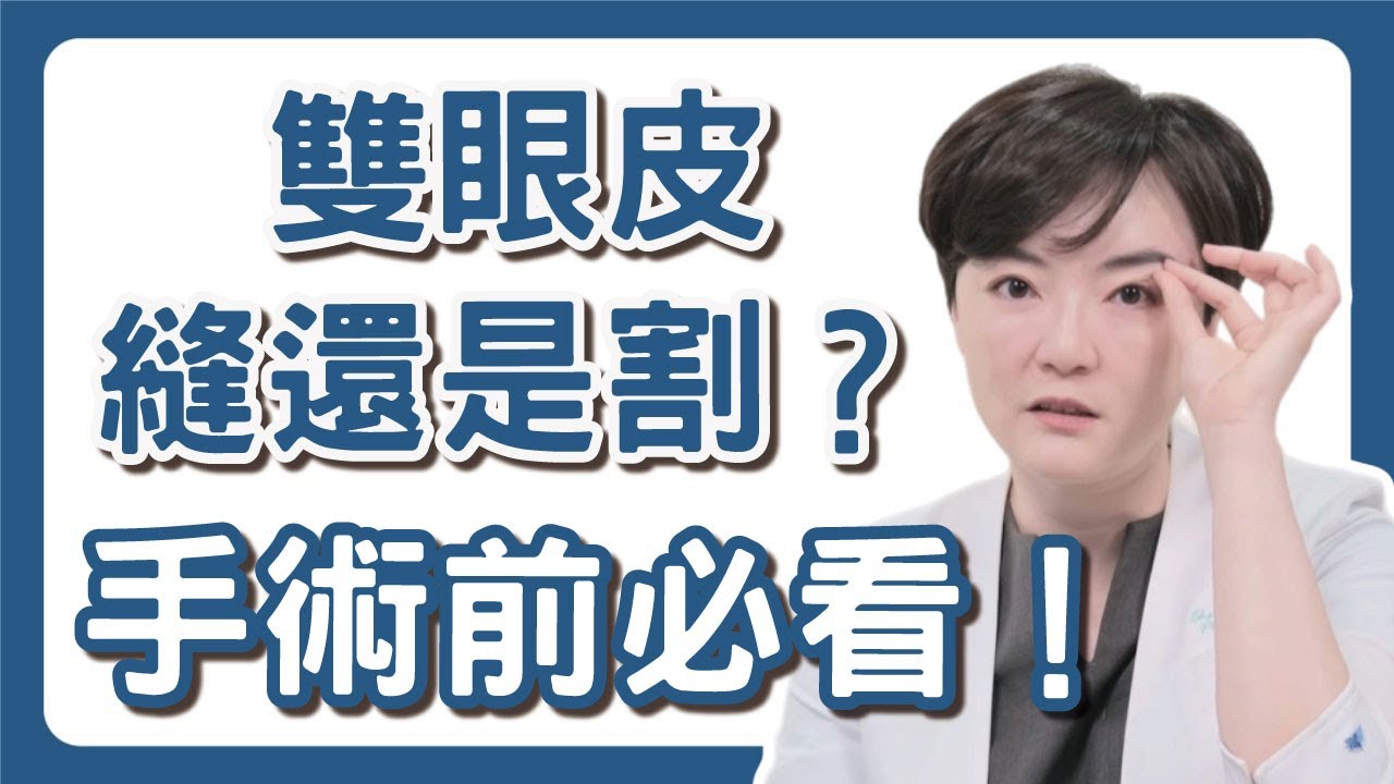 割雙眼皮、縫雙眼皮這兩個差很多？害怕手術失敗？術前評估重點一次告訴你！