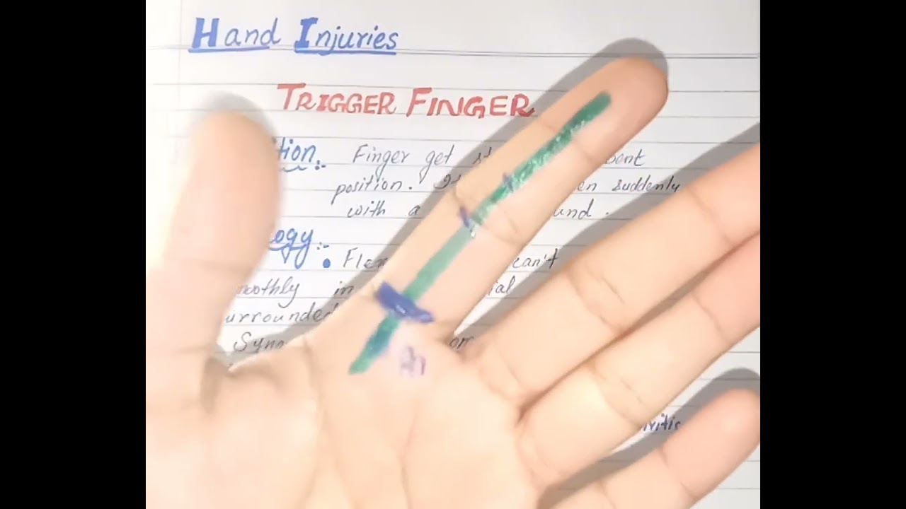 Trigger Finger