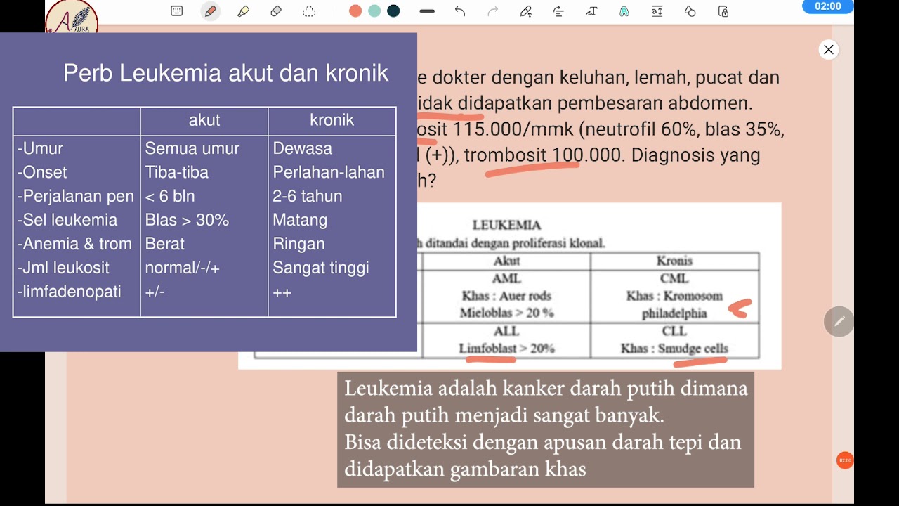 Soal UKMPPD - Leukemia (Kanker darah) Lemas, Pucat, Mimisan