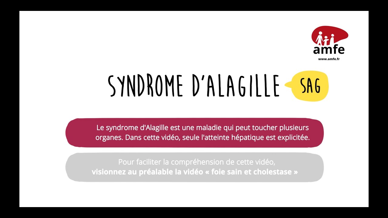 Syndrome d'Alagille (SAG)