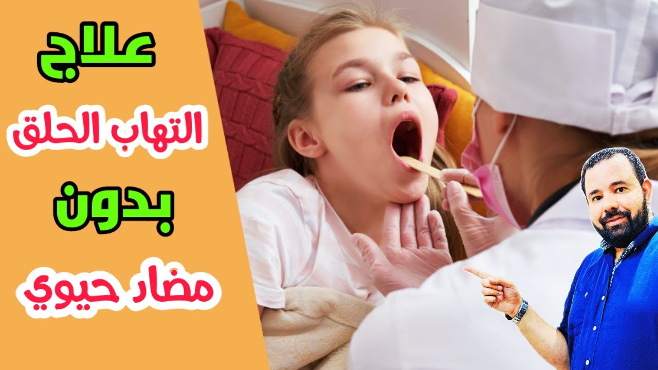 علاج التهاب الحلق بدون مضاد حيوي