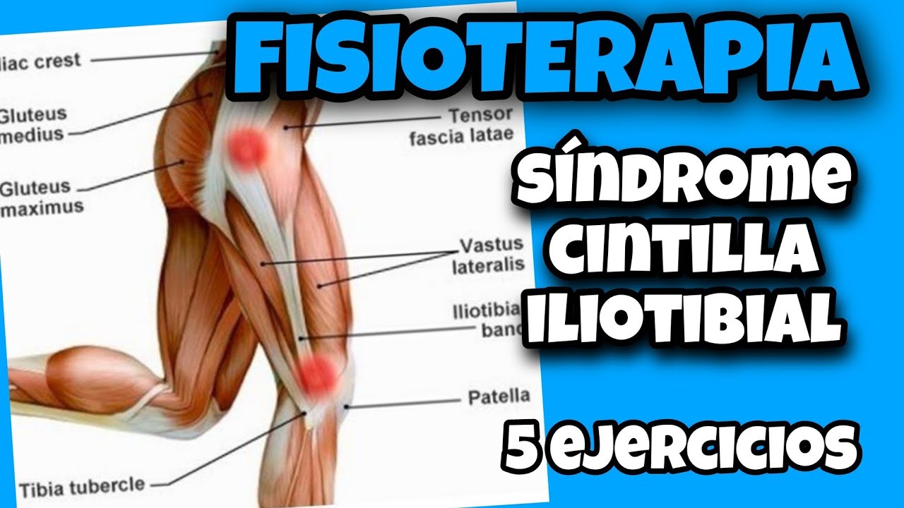 💪 EJERCICIOS recuperación CINTILLA ILIOTIBIAL fisioterapia