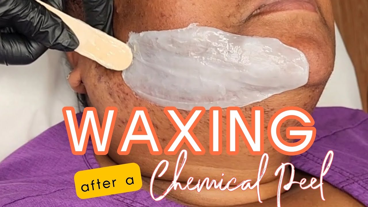 WAXING AFTER A CHEMICAL PEEL!