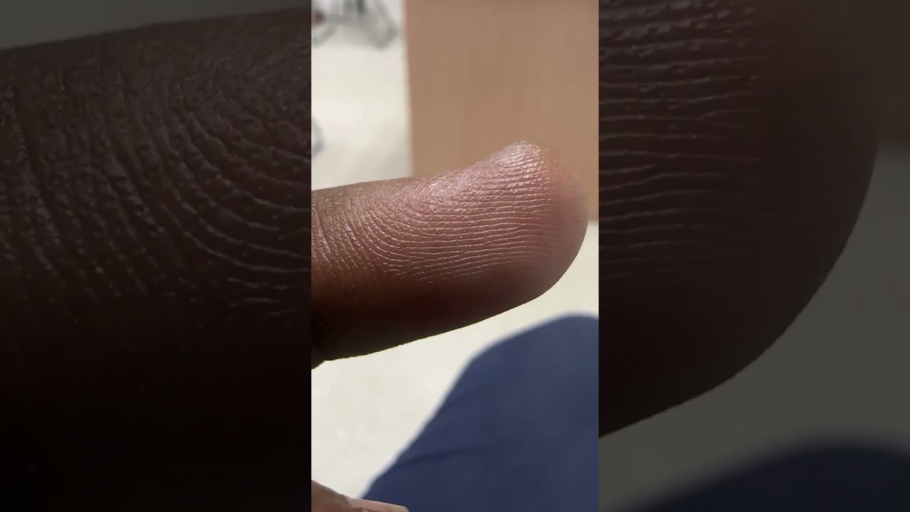 Finger micro zoom #iphone #instagram