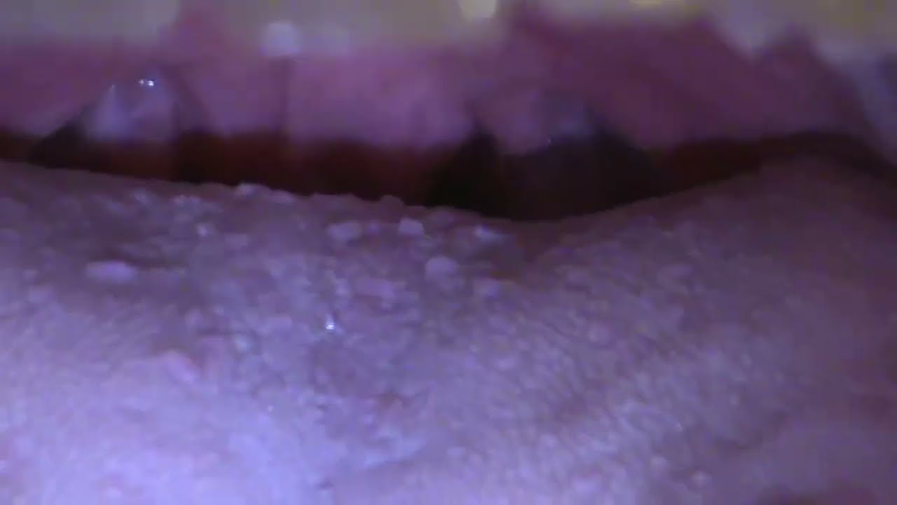 Uvula while singing part 2