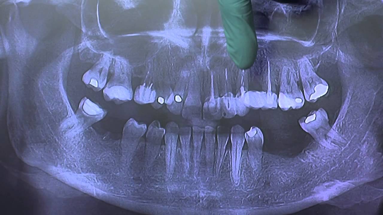 Smile make over with Dr. Parmar. Episode 1: introduction