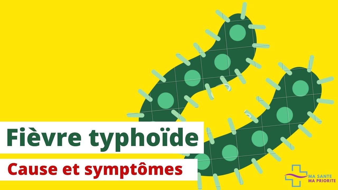 FIEVRE TYPHOIDE: CAUSE ET SYMPTOMES