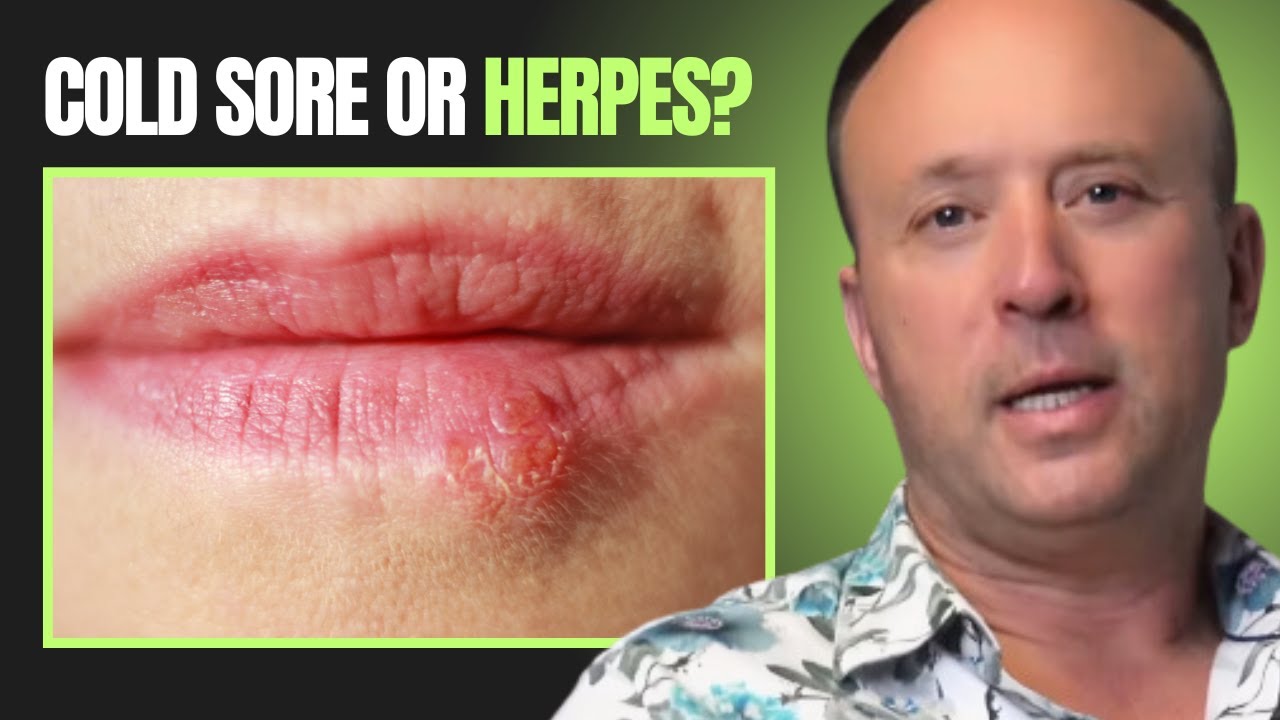 The Difference Between Cold Sores and Herpes