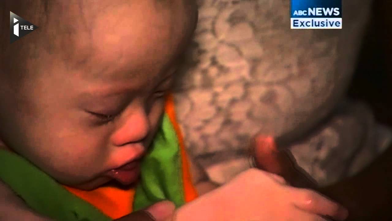 Un enfant trisomique abandonné par ses parents adoptifs
