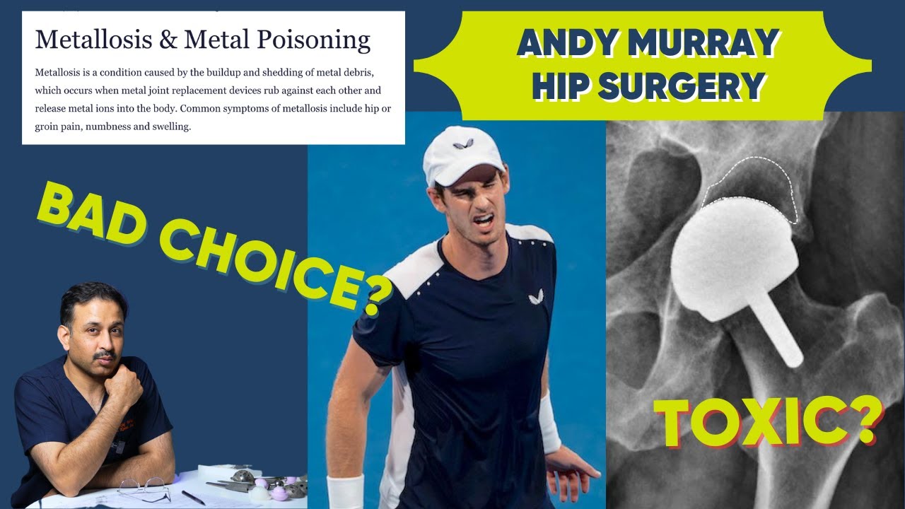Andy Murray’s Hip Replacement implants-are they Poisonous/toxic? ASR Implants Recall #hipreplacement