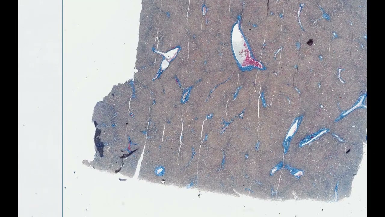 Wątroba ludzka barwienie metodą Mallory ego