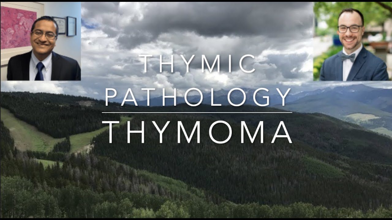 Fresh Air with the Lung Path Guys: Thymoma