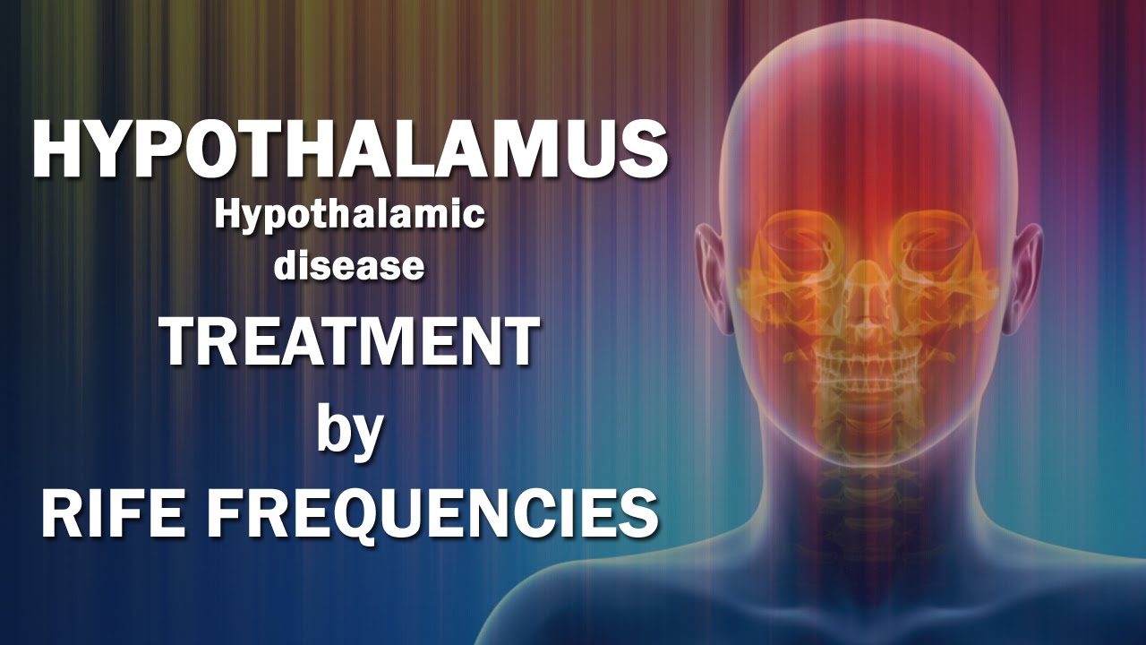 Hypothalamus Healing Frequency (Disease) - RIFE Frequencies Treatment - Energy & Quantum Medicine
