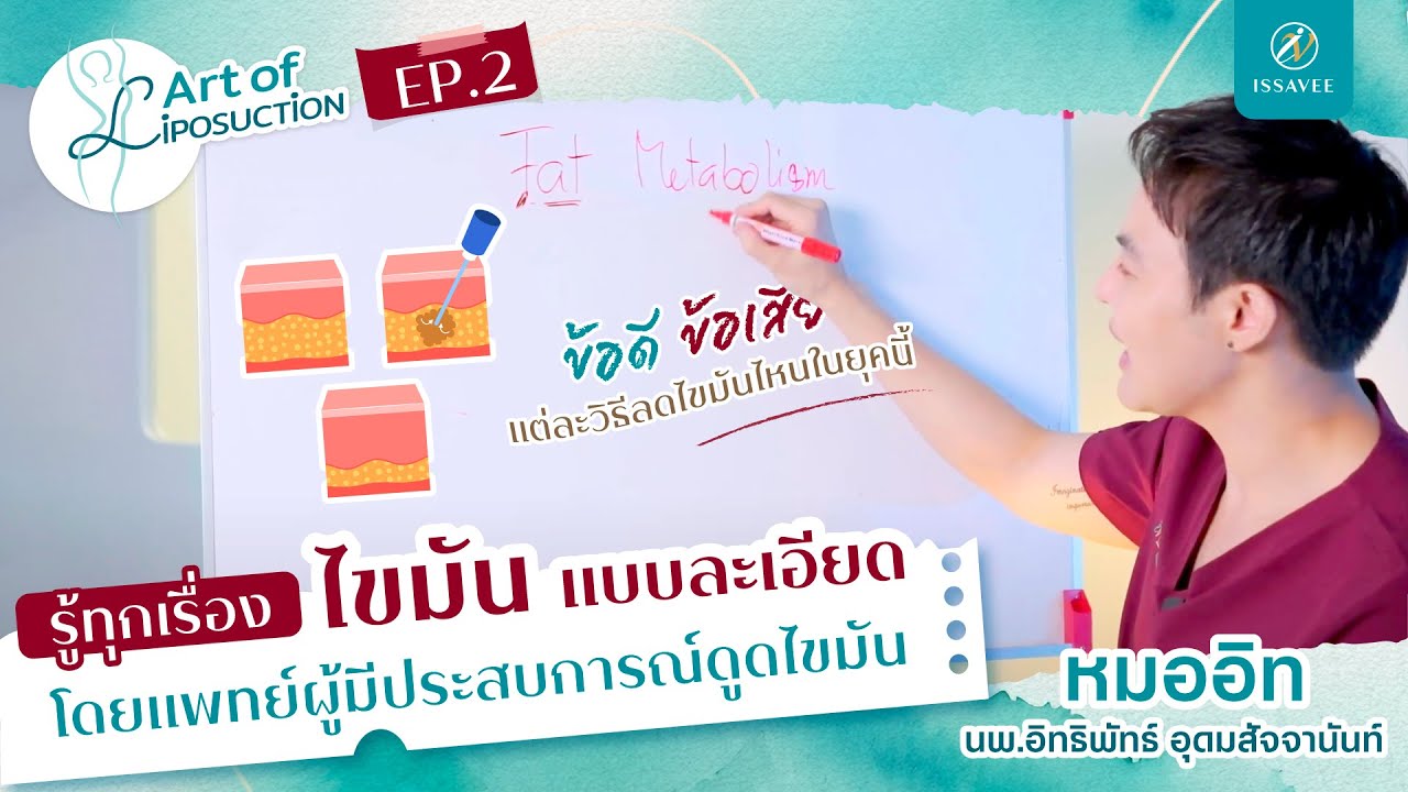 รู้ทุกเรื่อง #ดูดไขมัน ในคลิปเดียว ตั้งแต่ต้นจนจบการรักษา กับหมออิท [ART OF LIPOSUCTION I EP.1]