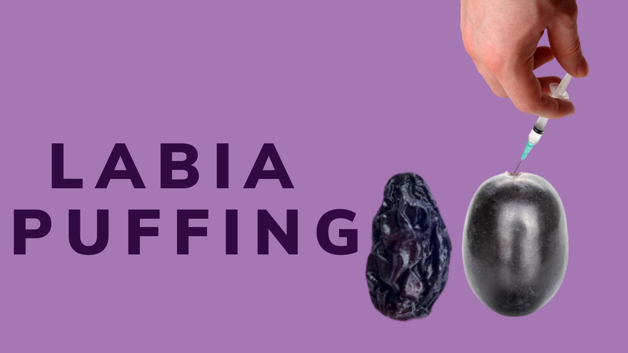 Labia Puffing in Los Angeles | Dr. Michael Tahery