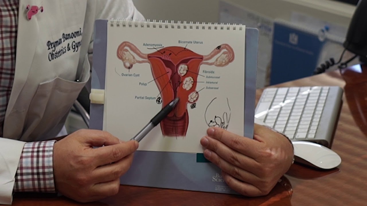 The different types uterine fibroids
