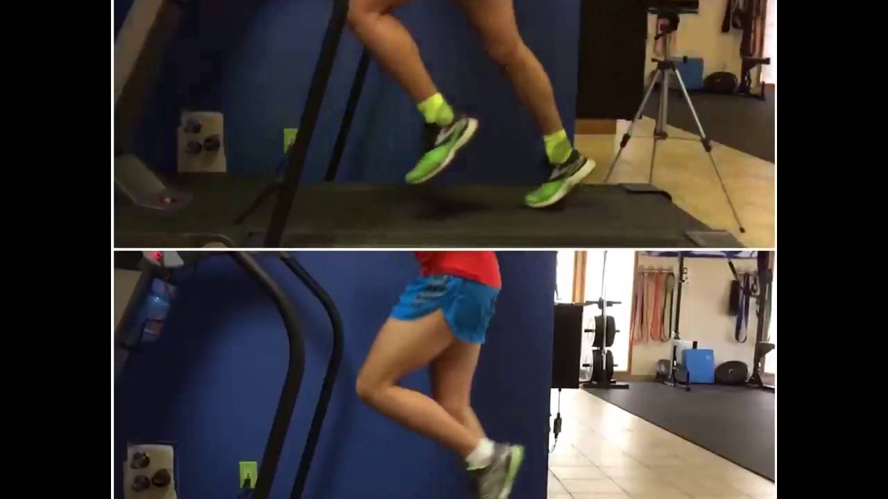 Stride Comparison during Haglund's Deformity Recovery