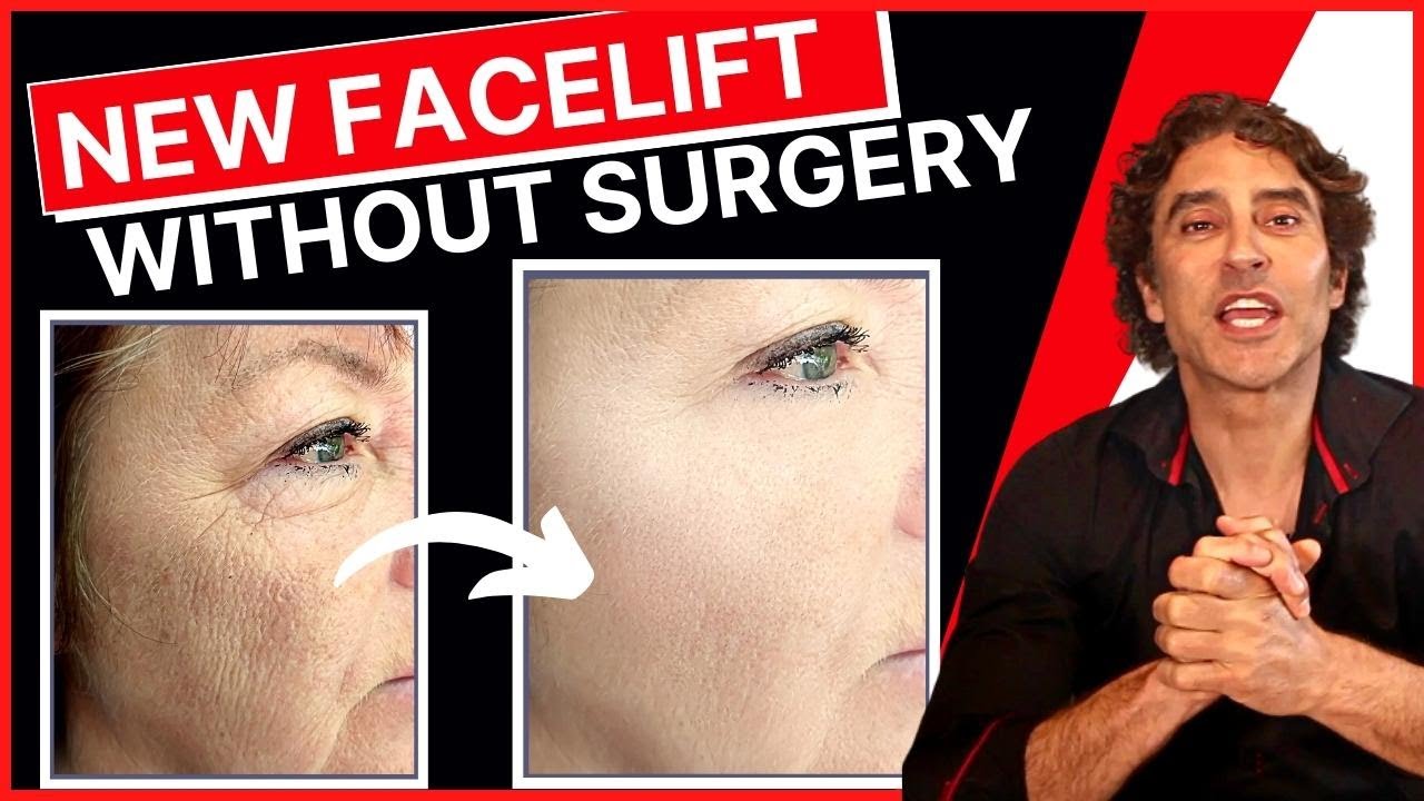 NEW PROCEDURE Facelift WITHOUT Surgery 🔥 Ellacor Micro Coring