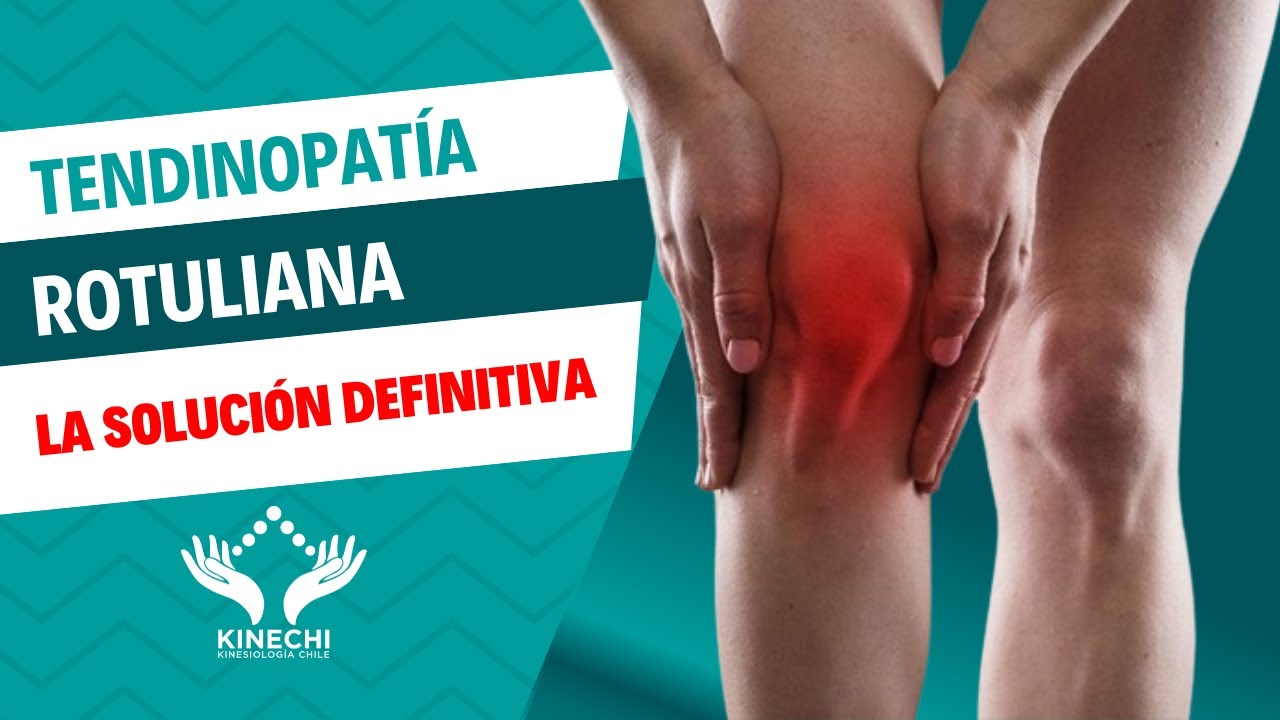 Tendinitis | Tendinosis | Tendinopatía rotuliana Rehabilitación: Objetivos, ejercicios, infiltración